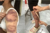 Công an Bắc Ninh tạm giữ người đàn ông đánh đập vợ con