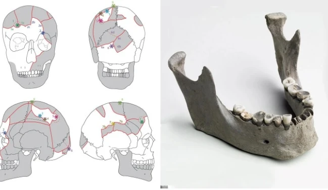 Phát hiện hài cốt đầm lầy hơn 5.000 tuổi, lộ sự thật xé lòng