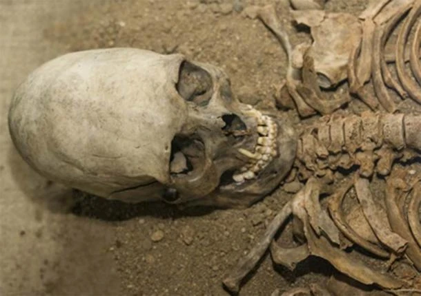 Giải mã tập tục khiến hộp sọ dài như quả trứng của người xưa