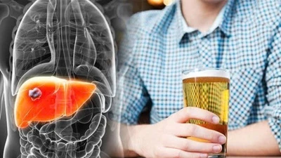 Cảnh báo 4 bệnh âm thầm đe dọa người uống rượu bia