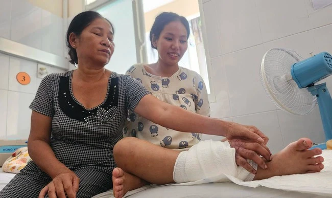 Ghép tạm tay đứt lìa vào chân bảo tồn tay cho thai phụ mang song thai