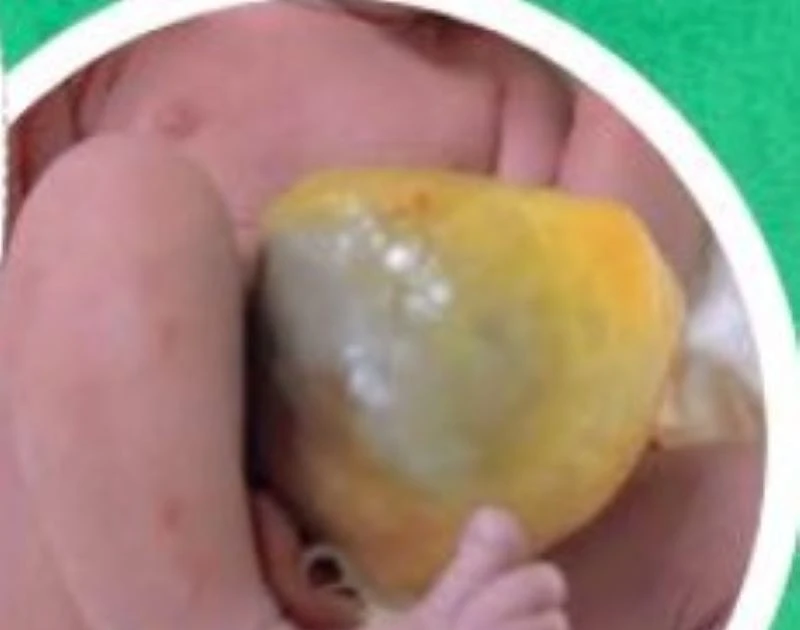 Sàng lọc trước sinh quyết định hành trình an toàn của mẹ và bé