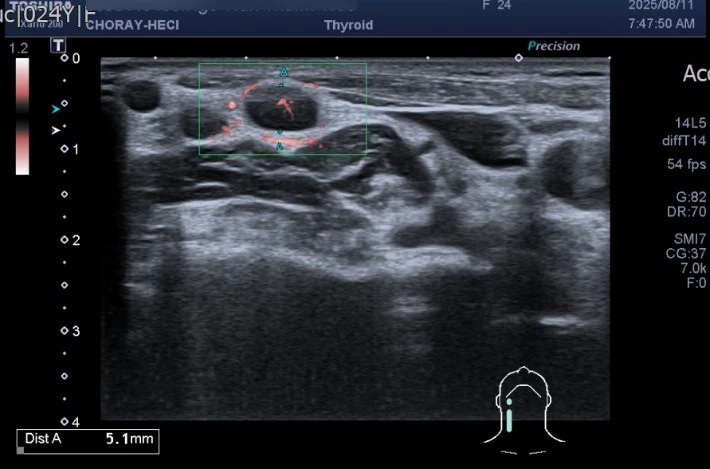 Loại ung thư có tỷ lệ mắc cao nhất ở nữ giới khi đi khám