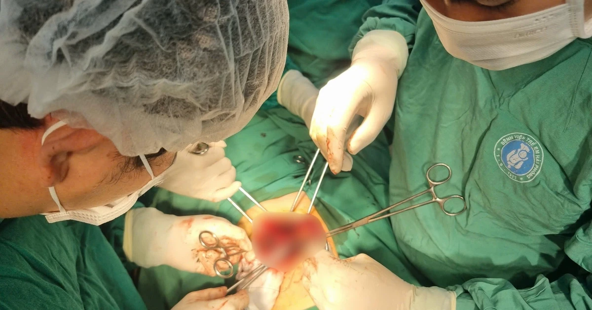 Bé hơn 2 tuổi ngồi sau xe máy ngã vỡ gan nguy kịch