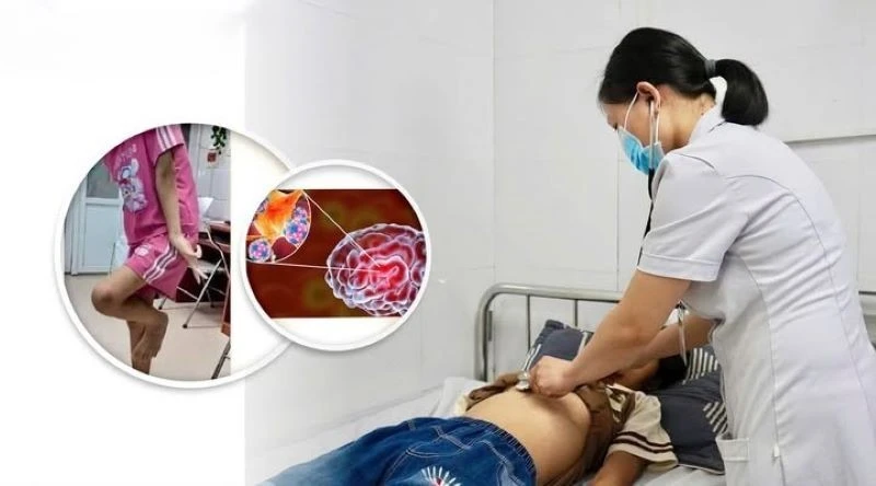 Rối loạn giấc ngủ, bé gái 12 tuổi phát hiện sớm viêm não tự miễn