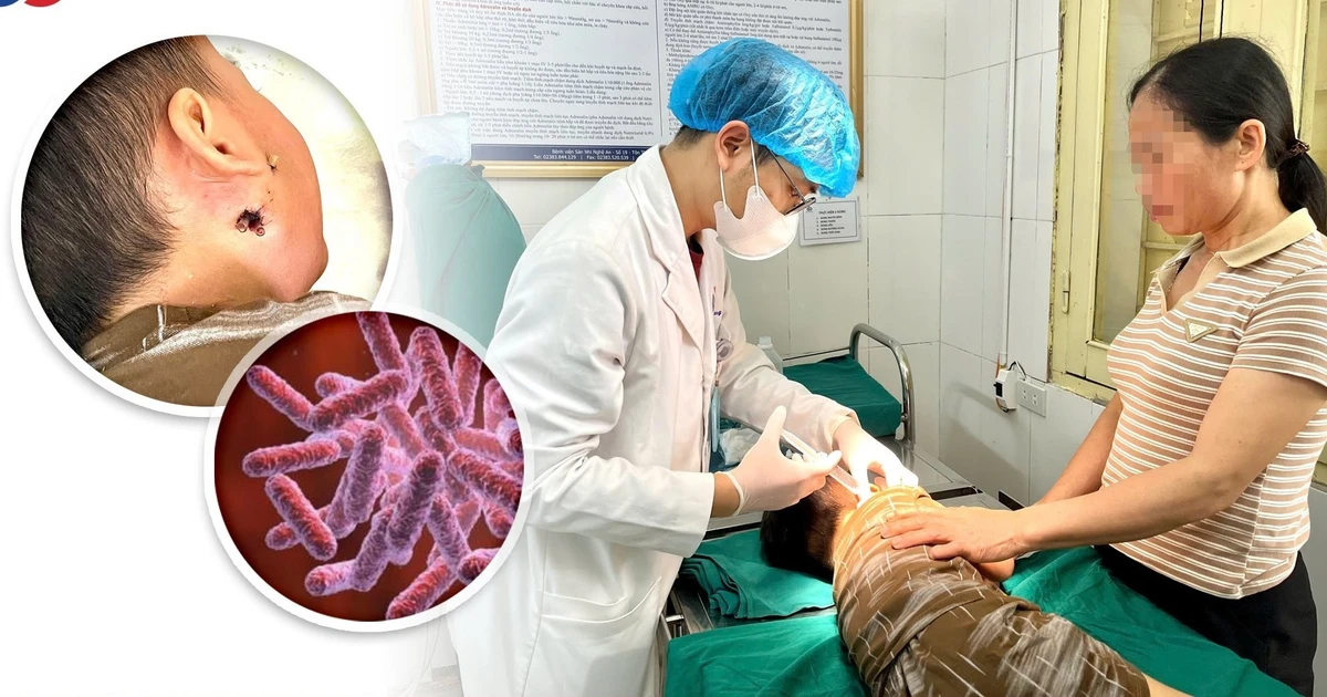 Bé 4 tuổi bị vi khuẩn ăn thịt người tấn công nguy kịch