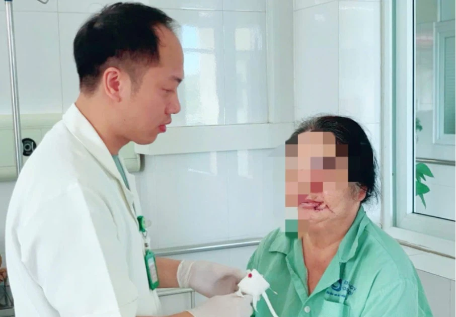 Sần cục trên da không ngờ ung thư da mặt