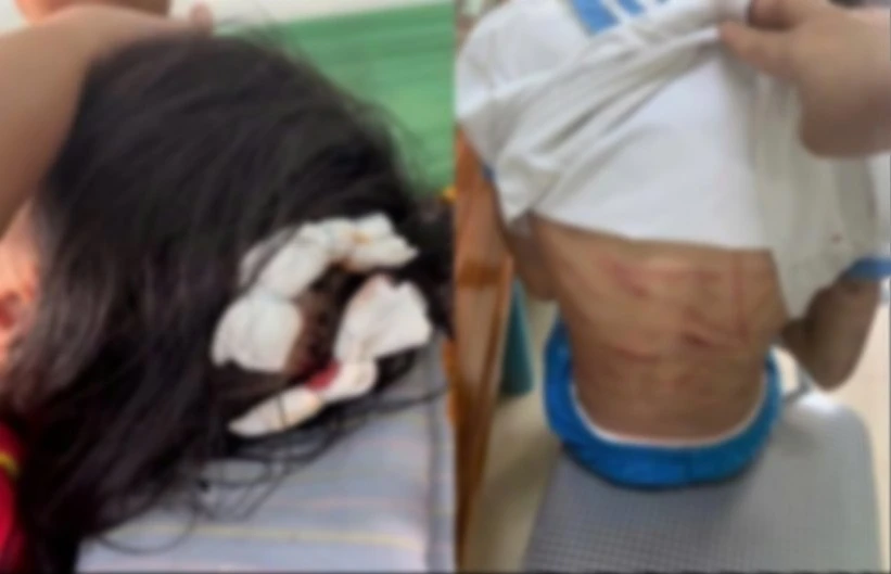 Lời khai man rợ của gã cha dượng bạo hành bé gái ở Hà Tĩnh