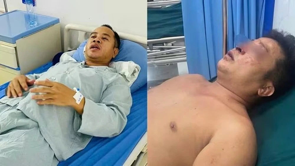 Khởi tố 3 kẻ hành hung hai anh em giúp người gặp nạn