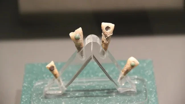 View - Tìm thấy trẻ em Maya 7 tuổi có ngọc răng xanh biếc kỳ lạ | Báo Tri thức và Cuộc sống - TIN TỨC PHỔ BIẾN KIẾN THỨC 24H