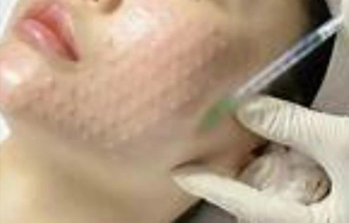 Gallery - Cẩn trọng với 'bẫy' làm đẹp siêu tốc cận Tết | Báo Tri thức và Cuộc sống - TIN TỨC PHỔ BIẾN KIẾN THỨC 24H