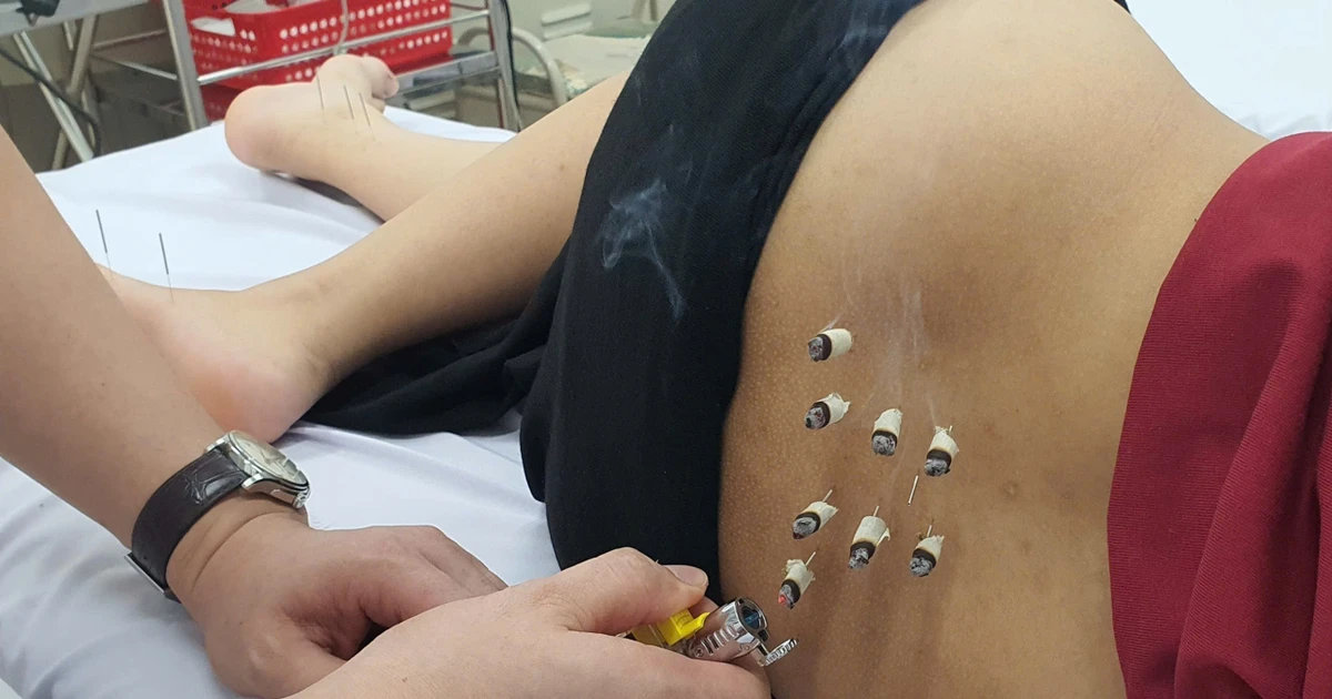 Gallery - Châm cứu trị bí tiểu sau sinh | Báo Tri thức và Cuộc sống - TIN TỨC PHỔ BIẾN KIẾN THỨC 24H