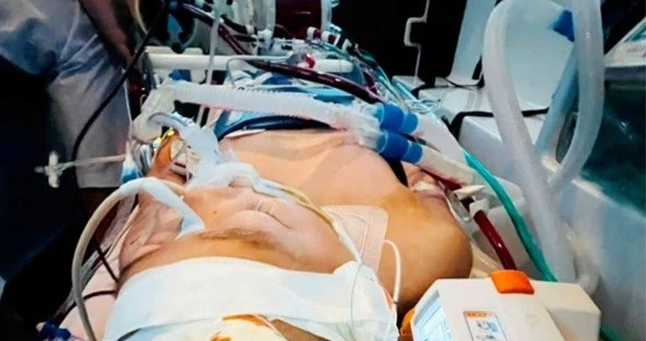 View - Hành trình hồi sinh trẻ 12 tuổi vỡ ổ dị dạng tủy cổ, hôn mê | Báo Tri thức và Cuộc sống - TIN TỨC PHỔ BIẾN KIẾN THỨC 24H