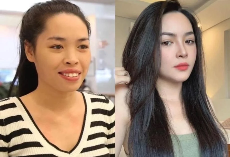 Nhan sắc hiện tại của hot girl từng 'lột xác' nhờ phẫu thuật thẩm mỹ