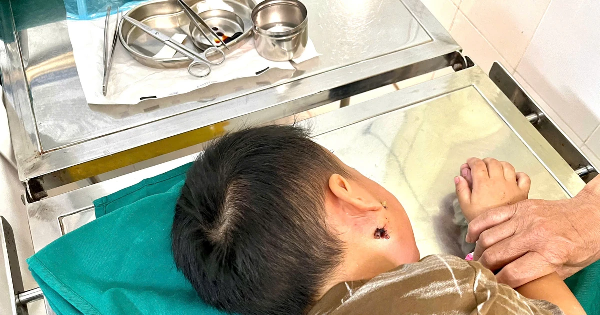 Bé 4 tuổi ở Nghệ An mắc bệnh whitmore nguy hiểm đã được xuất hiện