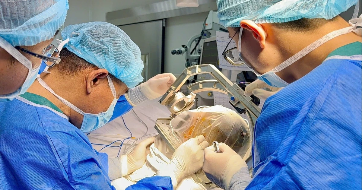 Thiếu nữ 16 tuổi thoát cơn động kinh nhờ kỹ thuật SEEG - đặt điện cực não sâu