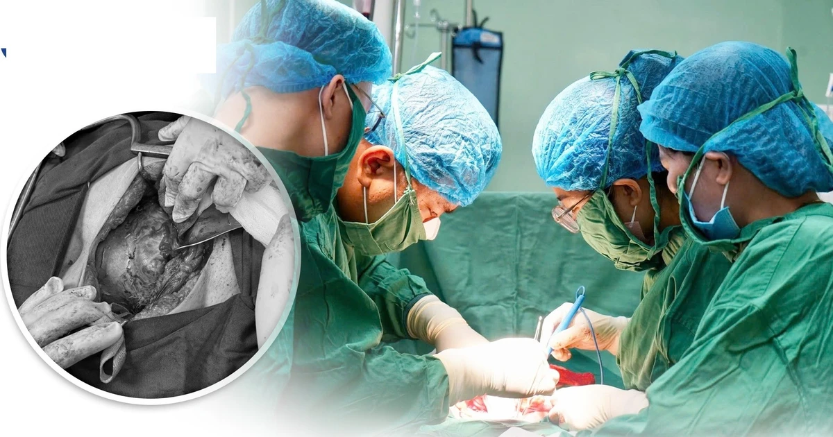 Bảo tồn tử cung cho sản phụ mắc rau cài răng lược thể nặng