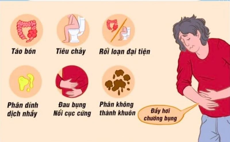 Hội chứng ruột kích thích, khi bệnh lành tính trở thành nỗi ám ảnh