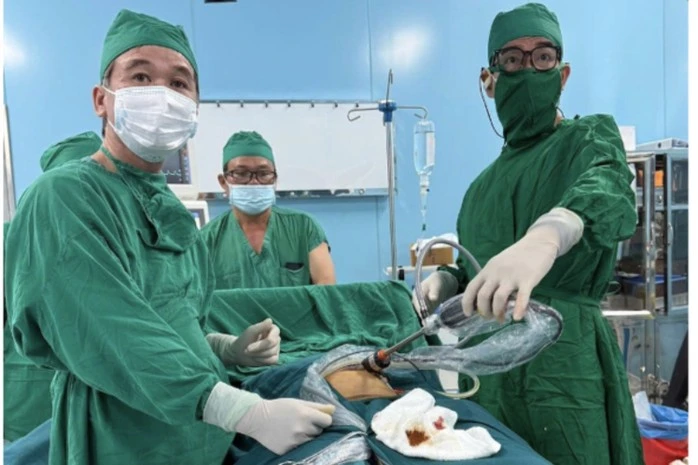 Nữ bệnh nhân 37 tuổi ở Côn Đảo mắc u quái buồng trứng