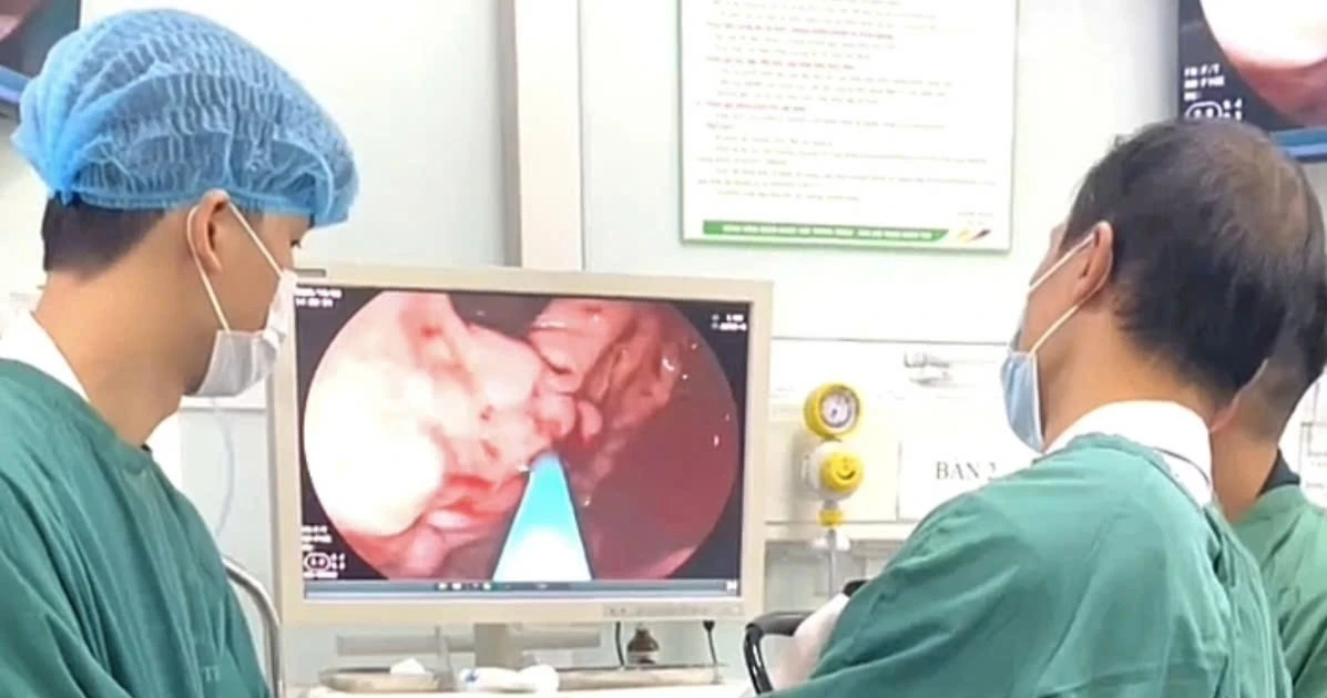 Đi ngoài phân đen, người đàn ông vỡ giãn tĩnh mạch, máu chảy thành tia