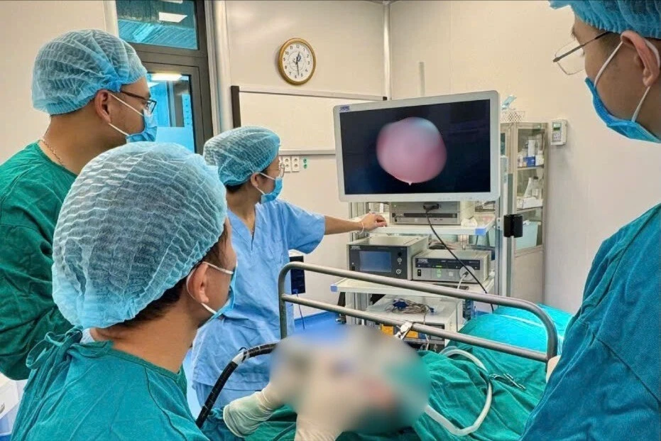 Bé sơ sinh 32 ngày tuổi mắc u nang hố lưỡi thanh thiệt khổng lồ hiếm gặp