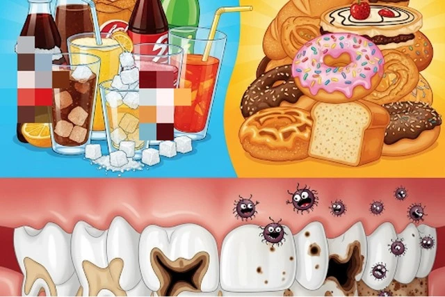 Thực phẩm chứa nhiều đường gây hại men răng