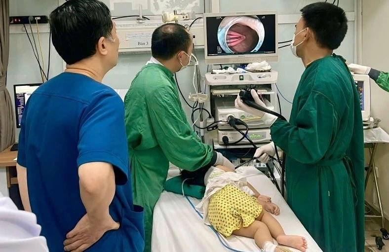 View - Bé gái 21 tháng tuổi nuốt kẹp tóc dài 5 cm | Báo Tri thức và Cuộc sống - TIN TỨC PHỔ BIẾN KIẾN THỨC 24H