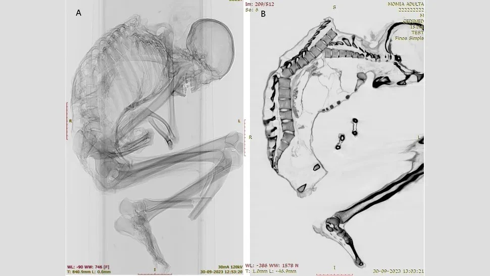 Gallery - Khám phá bất ngờ về xác ướp thợ mỏ ở sa mạc Atacama | Báo Tri thức và Cuộc sống - TIN TỨC PHỔ BIẾN KIẾN THỨC 24H
