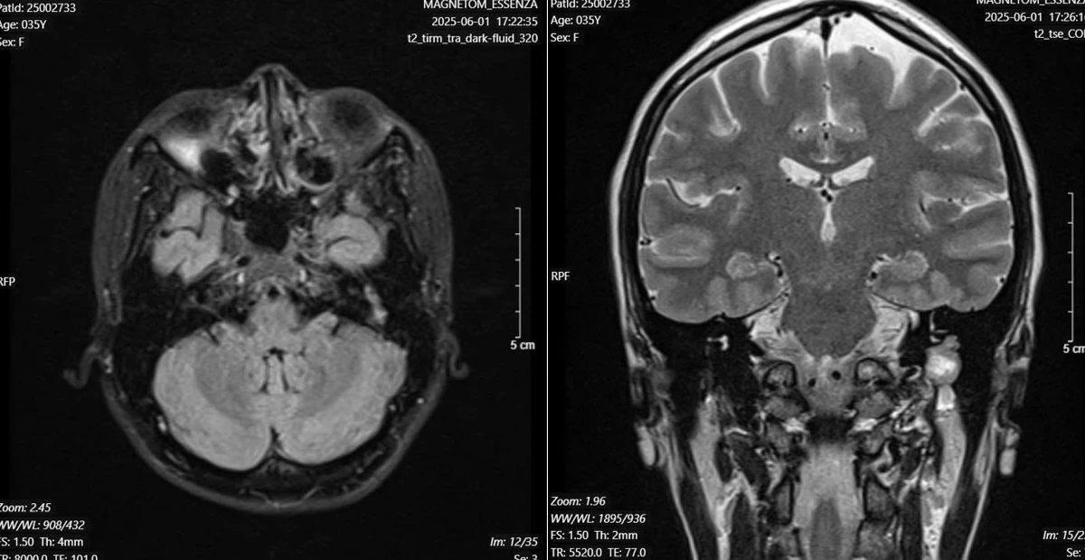 View - Lấy u, nối dây thần kinh chữa liệt mặt 10 năm cho người phụ nữ 35 tuổi | Báo Tri thức và Cuộc sống - TIN TỨC PHỔ BIẾN KIẾN THỨC 24H