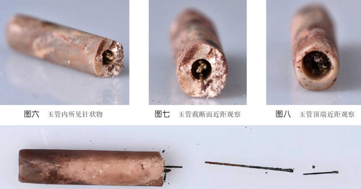 Bất ngờ phát hiện kim châm cứu bằng thép cổ nhất thế giới