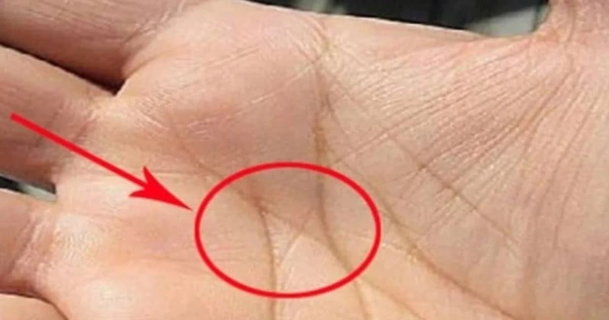 View - Dấu hiệu đặc biệt trên lòng bàn tay báo hiệu vận mệnh giàu sang | Báo Tri thức và Cuộc sống - TIN TỨC PHỔ BIẾN KIẾN THỨC 24H