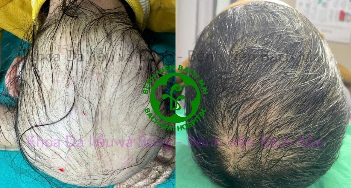 View - Chăm sóc tóc đúng cách, tránh tổn thương nang tóc lâu dài | Báo Tri thức và Cuộc sống - TIN TỨC PHỔ BIẾN KIẾN THỨC 24H