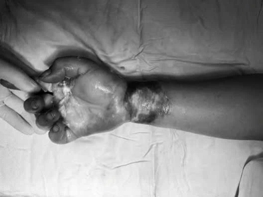 View - Bỏng điện nguy kịch khi dựng cây nêu đón Tết, cách gì phòng tránh? | Báo Tri thức và Cuộc sống - TIN TỨC PHỔ BIẾN KIẾN THỨC 24H