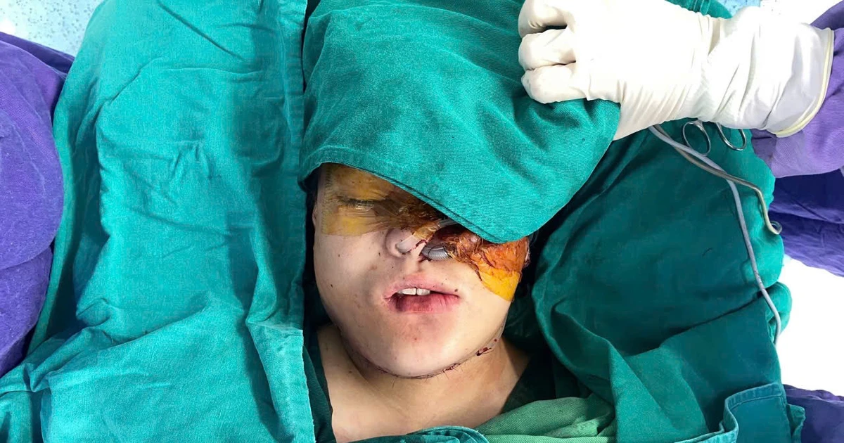 9 giờ phẫu thuật tái tạo gương mặt cho bé gái người dân tộc thiểu số