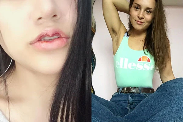 Môi “mazda” và những trào lưu làm đẹp khó hiểu của hội chị em | Báo Tri ...