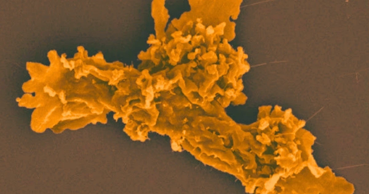 View - Bí ẩn sinh vật 'bất tử nhiệt', sức chịu nhiệt vượt ngưỡng sự sống | Báo Tri thức và Cuộc sống - TIN TỨC PHỔ BIẾN KIẾN THỨC 24H