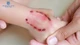 Bé 8 tuổi suy hô hấp, tổn thương não sau 5 tháng bị chó cắn