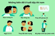 Dậy thì 'lệch chuẩn', khi nào cần đi khám?