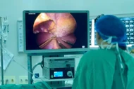 Tưởng đau cột sống do thoát vị không ngờ u tủy chèn ép