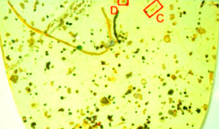 Dùng công nghệ thăm dò micro-CT độ phân giải cao, các chuyên gia phát hiện, xúc tu của con sán giây này lõm một phần, có dạng móc độc đáo, tương tự như xúc tu của sán dây trypanorhynch còn tồn tại ở hiện nay. Ảnh: @Viện Hàn lâm Khoa học Trung Quốc.