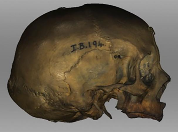 Hộp sọ có biệt danh là Hilda ban đầu được tặng cho Hiệp hội Phrenological của Đại học Edinburgh vào năm 1833, và không ai biết chính xác niên đại của nó. Ảnh: @Karen Fleming.