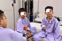 Báo động nhiều người nguy cơ mất thị lực vĩnh viễn do pháo nổ