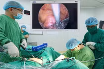 Đính lưới nhân tạo hiệu quả điều trị sa sinh dục tới 30 năm