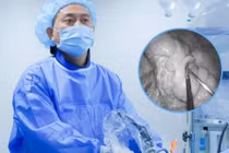 Tiêu chảy kéo dài, cụ ông 80 tuổi sốc nhiễm trùng vì thủng đại tràng sigma