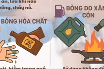 Cách xử lý bỏng nặng hiệu quả để tránh biến chứng