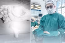 Nối thành công ngón tay đứt rời cho chiến sĩ công an