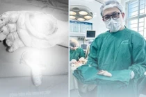 Nối thành công ngón tay đứt rời cho chiến sĩ công an