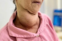 Bác sĩ thăm khám cho bệnh nhân sau phẫu thuật