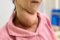 Bác sĩ thăm khám cho bệnh nhân sau phẫu thuật