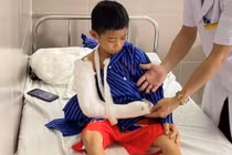 Nghỉ hè 1 tháng 50 trẻ nhập viện do tai nạn thương tích 